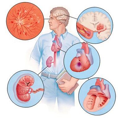 Cardiol previne o desenvolvimento de doenças concomitantes